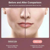 V-line Face Lifting Device with LED Therapy - Mega Cart